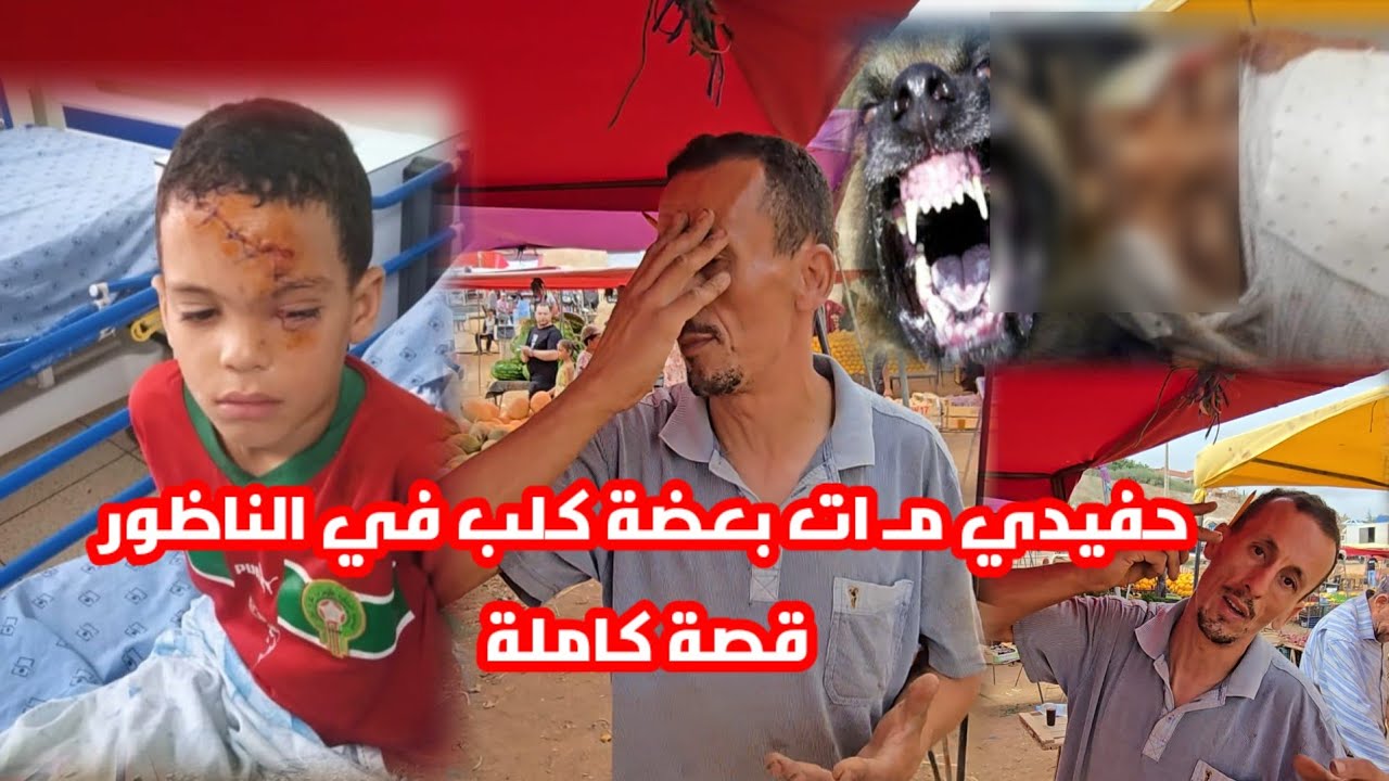 الكلب قتـ ل ليا حفيدي وحنا محروقين عليه والوالدين ديالو مزالين محروقين عليه هذه هي القصة الكاملة