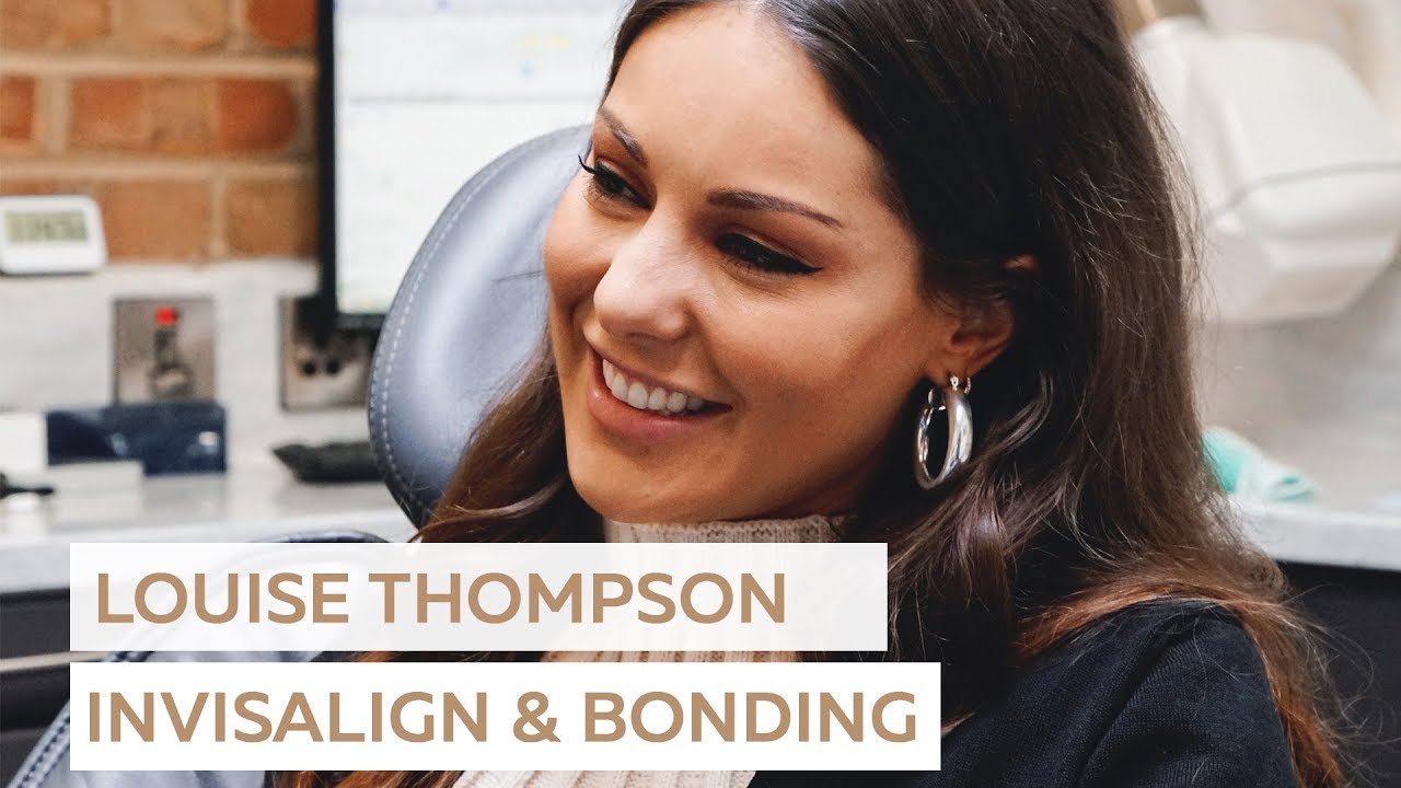 Louise Thompson | Teeth Transformation with Invisalign and Composite Bonding
