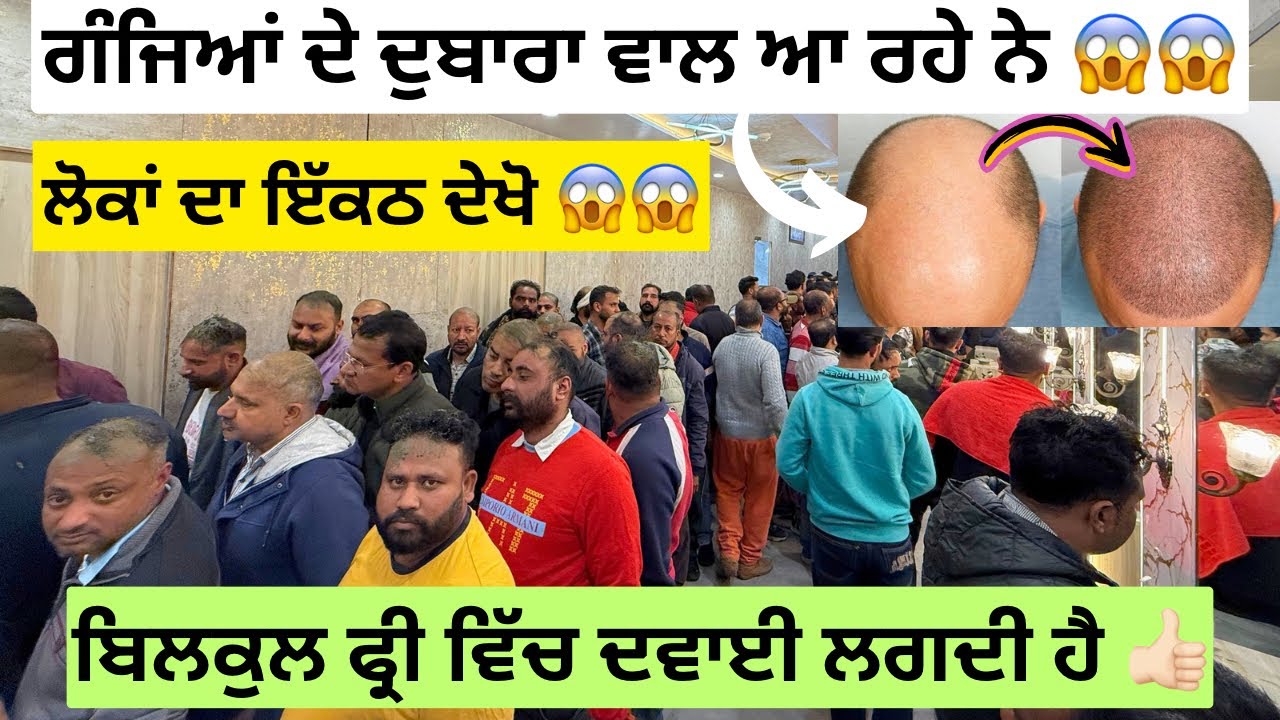 ਬਿਲਕੁਲ ਫ੍ਰੀ ਦੇ ਵਿੱਚ ਇੱਥੇ ਲੱਗਦੀ ਹੈ ਵਾਲਾਂ ਦੀ ਦਵਾਈ 👍🏻 | ਗੰਜਿਆਂ ਦੇ ਵੀ ਦੁਬਾਰਾ ਵਾਲ ਆ ਰਹੇ ਨੇ 😱 | #hairfall