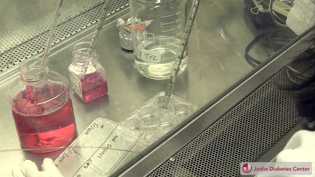 Joslin Scientists Advance Understanding of Human Brown Adipose Tissue and Grow New Cells