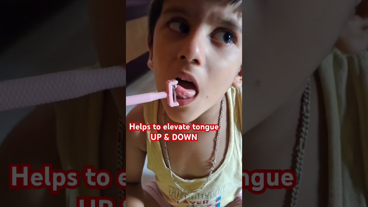 Apraxia of Speech Treatment | SPEECHGEARS TT-UD without spring #rockstar #Speech Therapy #asd#autism