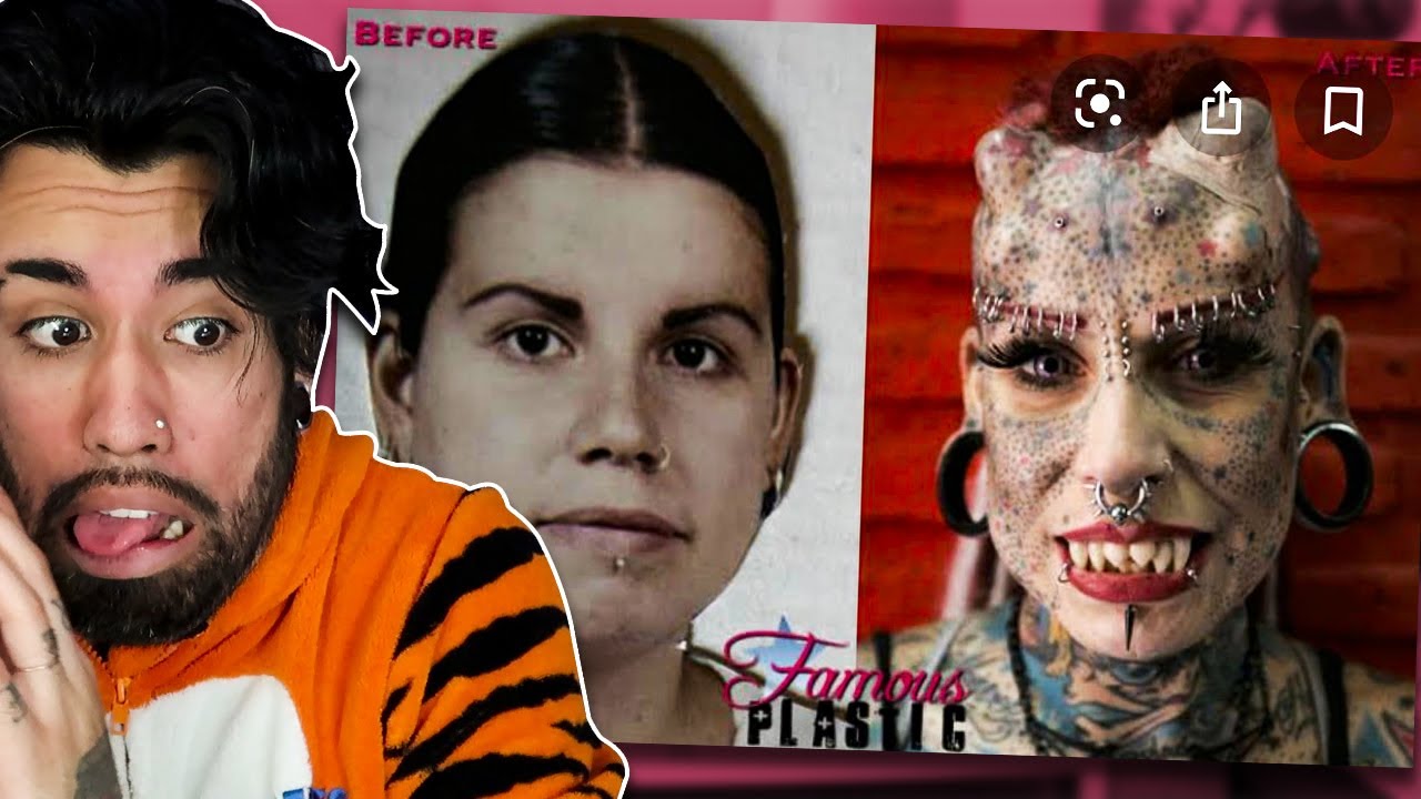 ANTES E DEPOIS DA MODIFICA&Ccedil;&Atilde;O CORPORAL