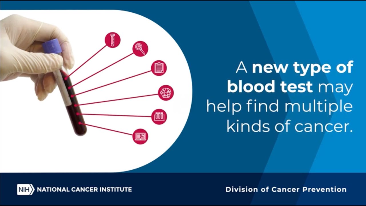 What are Multi-Cancer Detection Tests?