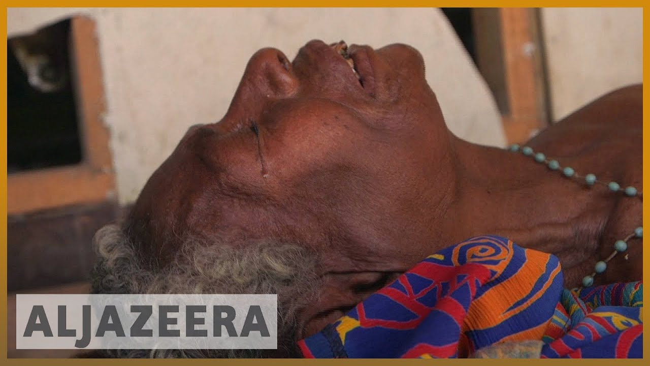 🇵🇬Health crisis: Papua New Guinea fights tuberculosis menace | Al Jazeera English