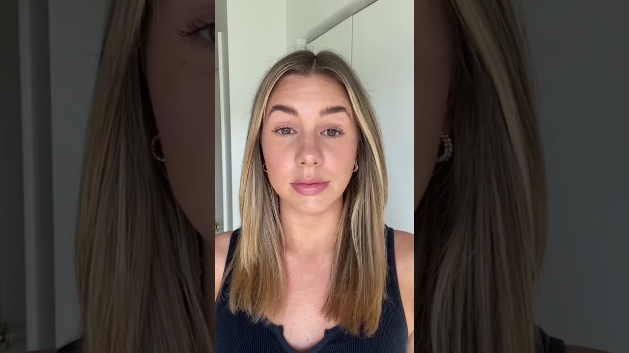 The Result of Baby Botox | Botox Forehead Results