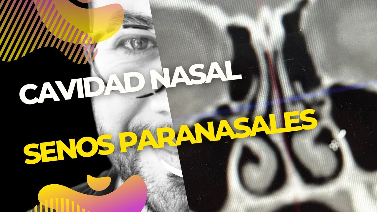 Cavidad Nasal, Senos Paranasales y Bulbo Olfatorio
