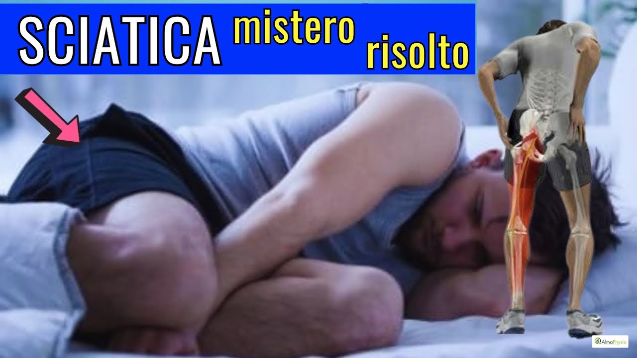 RIVELATO! Questo funziona per curare la SCIATICA