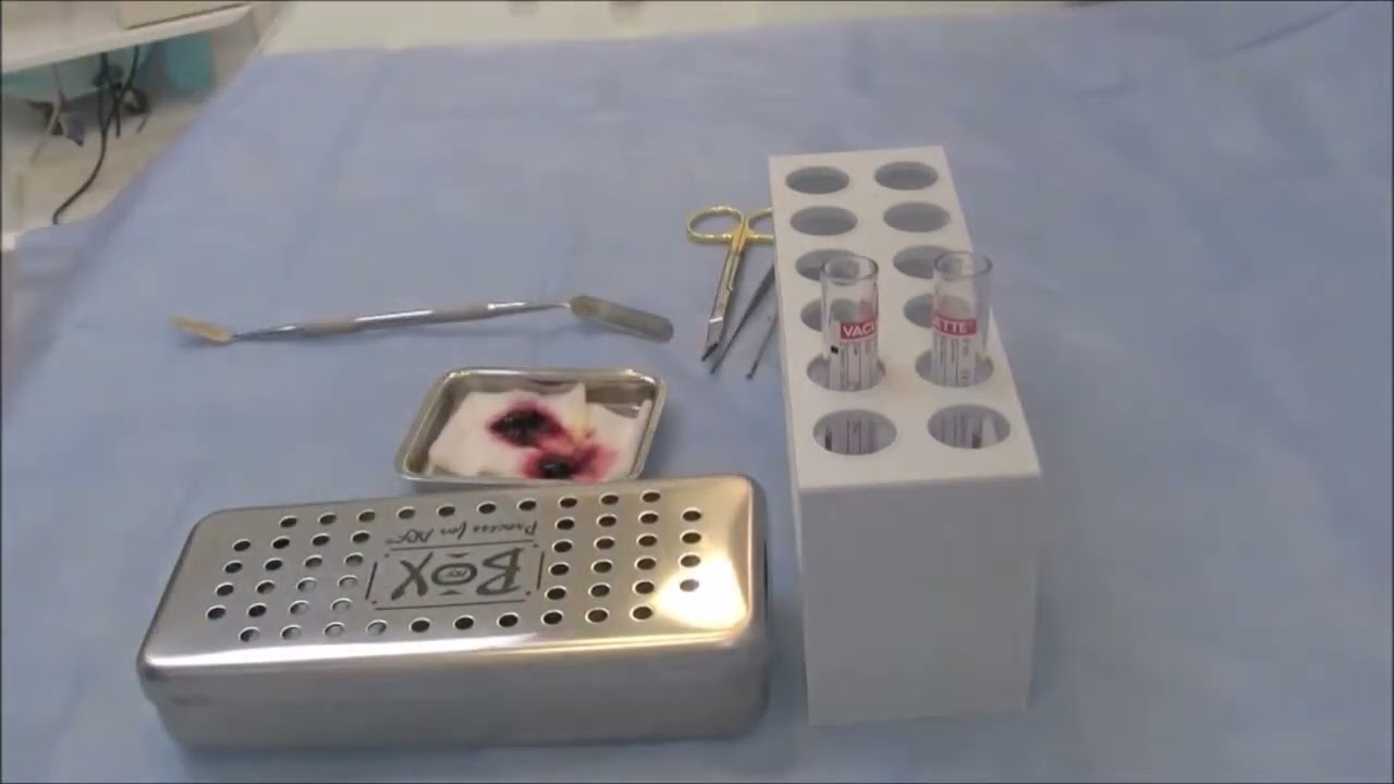 Dr.  Choukroun's Process for PRF Membrane Demonstration