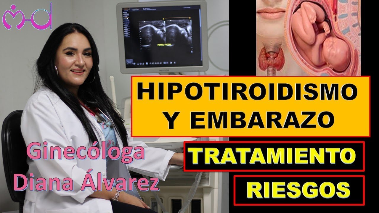 HIPOTIROIDISMO Y EMBARAZO, POR GINECOLOGA DIANA ALVAREZ