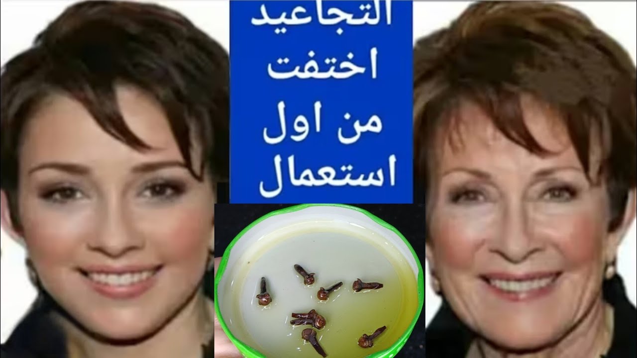 ثلاث قطرات فقط في الليل ‼️استيقظي ببشرة أصغر ب20 عام‼️أفضل زيت للبشرة يزيل التجاعيد فورا‼️