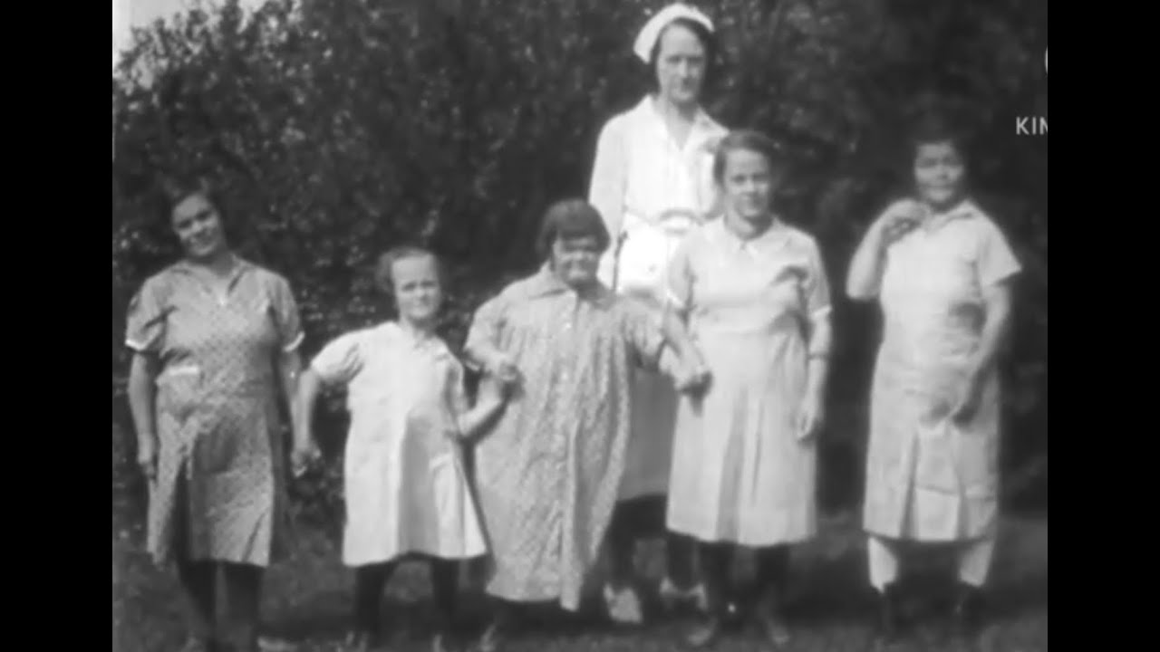 Cretinism. 1950s Medical Teaching film on the 