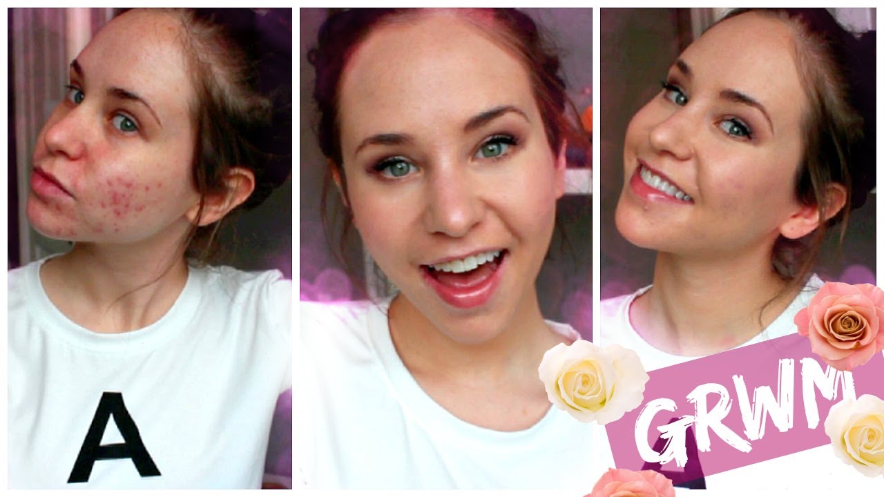Get Ready With Me: Makeup for Acne Coverage Foundation Routine