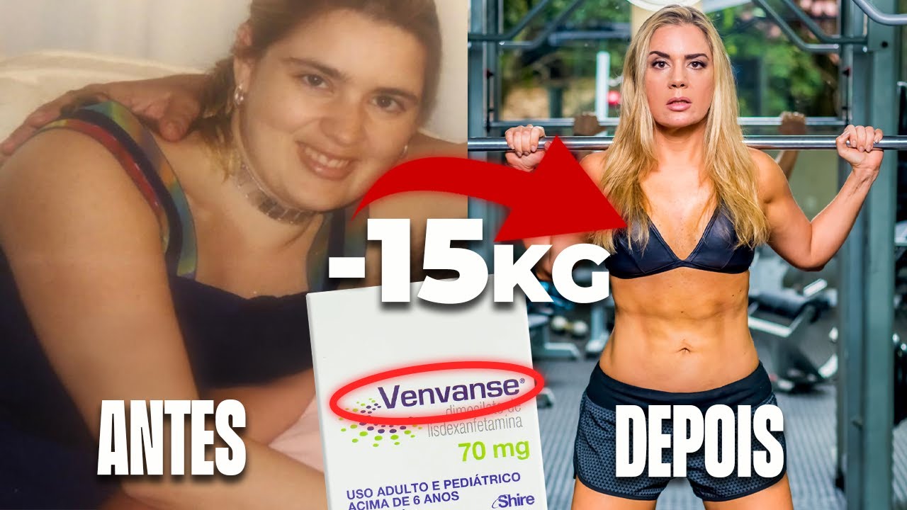 COMO EMAGRECI 15KG COM VENVANSE ! (sem rebotar)