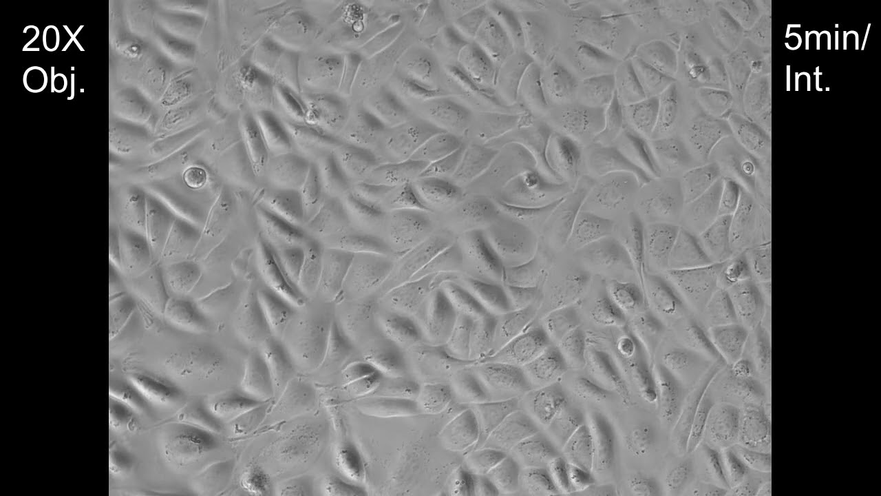 Immortalized Mouse Keratinocytes (Live Cell Imaging)