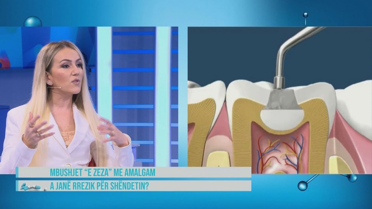 Hipokrati- Këshilla e stomatologes: Mos hiqni më shumë se një mbushje me amalgam në muaj pasi…