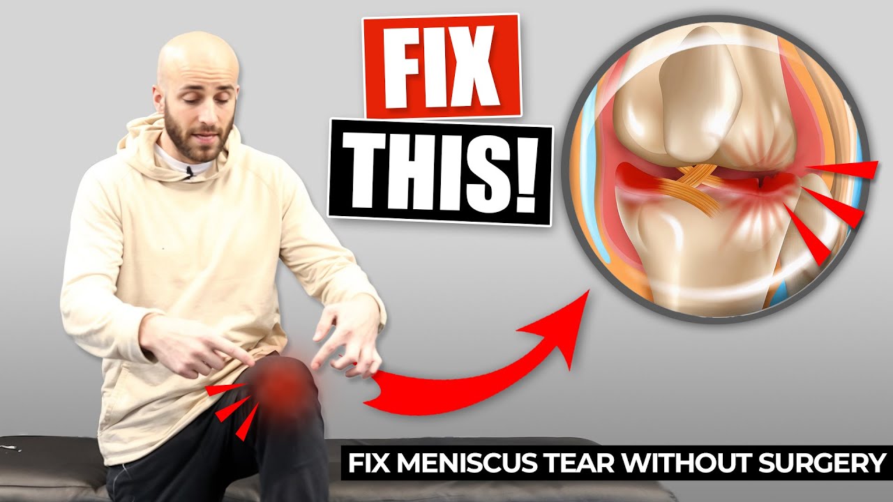FIX MENISCUS TEAR WITHOUT SURGERY (VERY EFFECTIVE EXERCISES!)