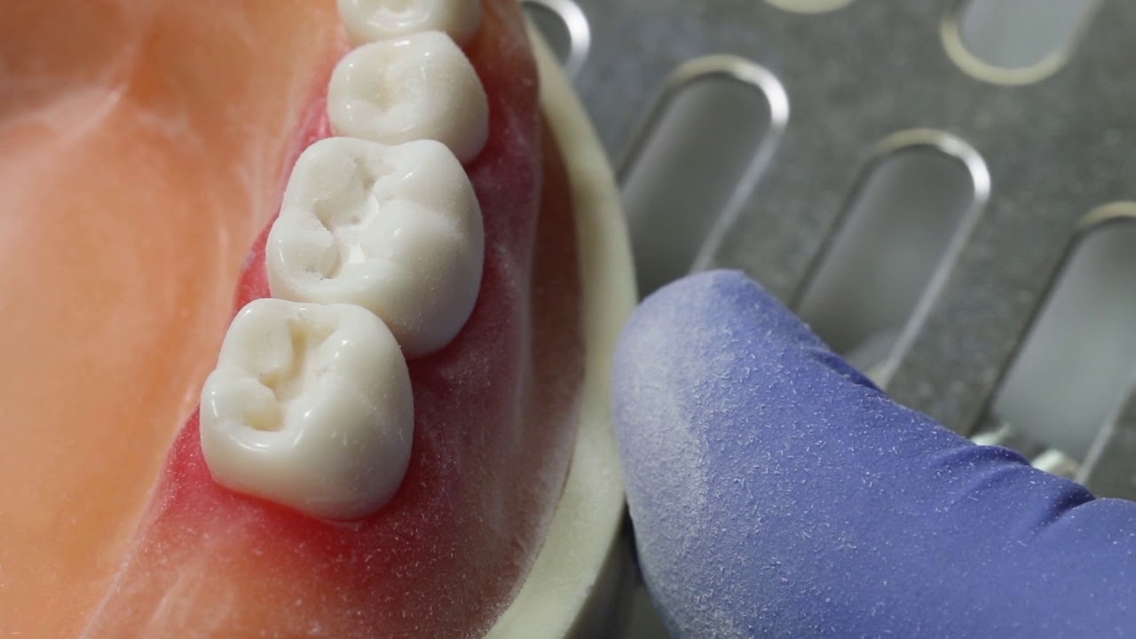 #30 Occlusal Amalgam Prep by Dr. James Keddington (UofU SOD)