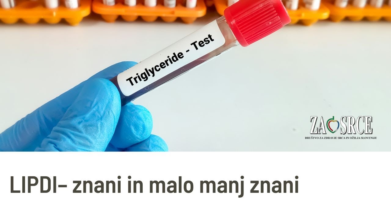 Predavanje: Lipidi - znani in malo manj znani