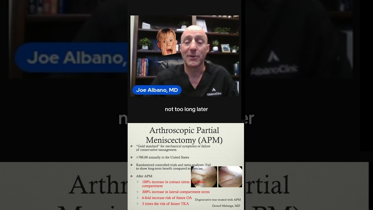 Why are we doing this? Questioning the necessity of over 700,000 partial meniscectomy surgeries.