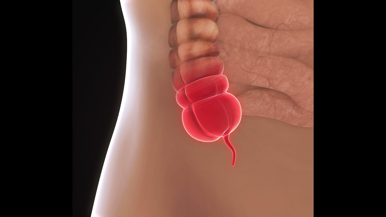 Board Exam Secrets- Appendix