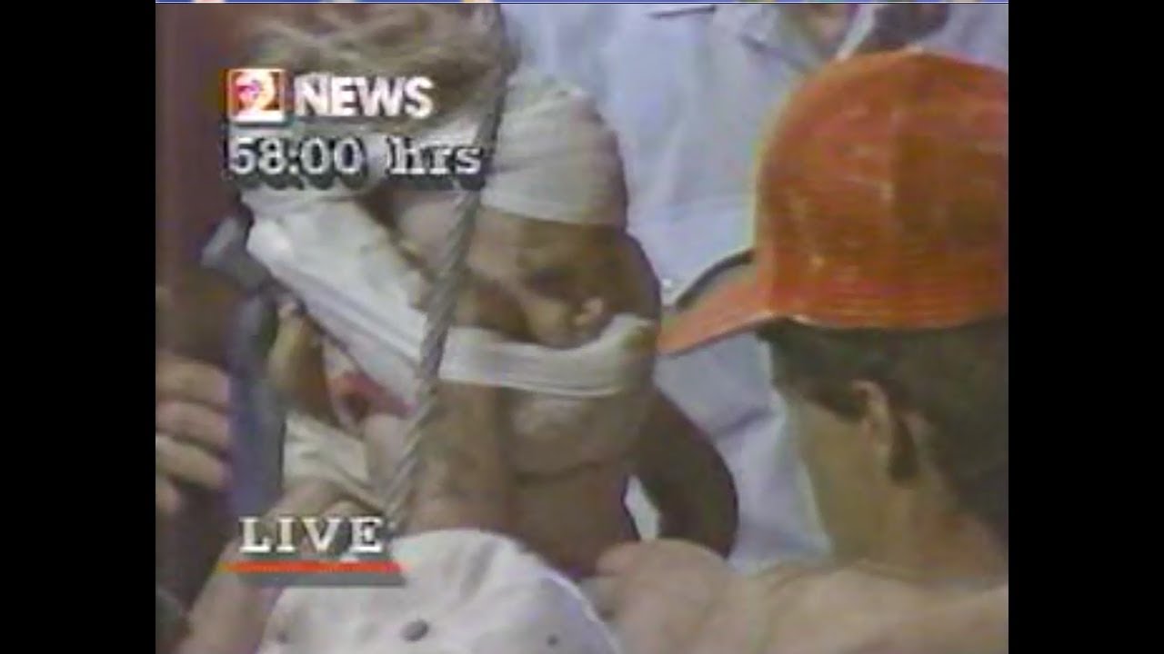 Baby Jessica rescued from water well - local coverage 1987