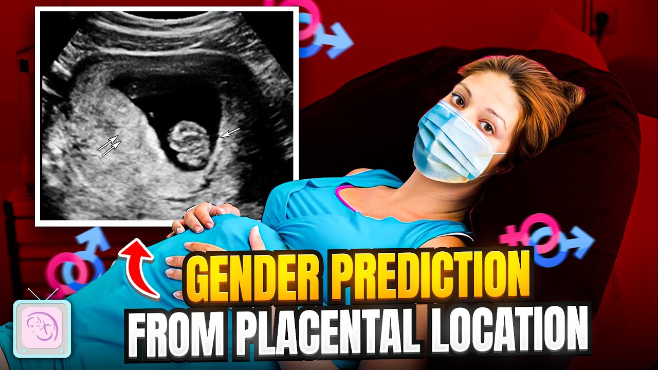Can you predict your baby's sex with The Ramzi Theory (placenta location)?
