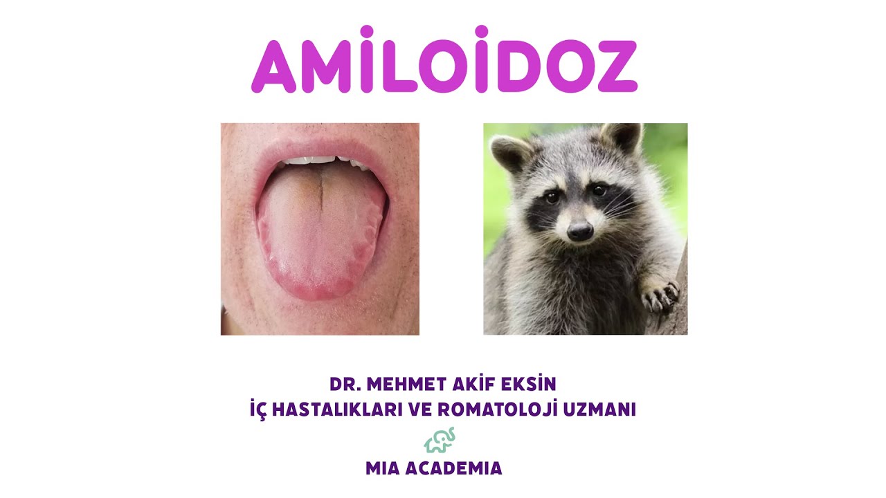 AMİLOİDOZ | SORULARLA KONU ANLATIMI - 4