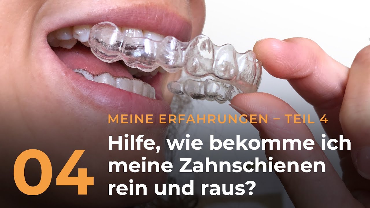 04 &ndash; Hilfe, wie bekomme ich die Zahnschienen rein und raus?