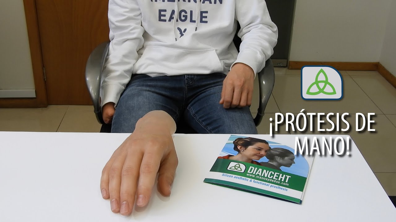 Prótesis estética de mano /Hand prosthetic No. 265
