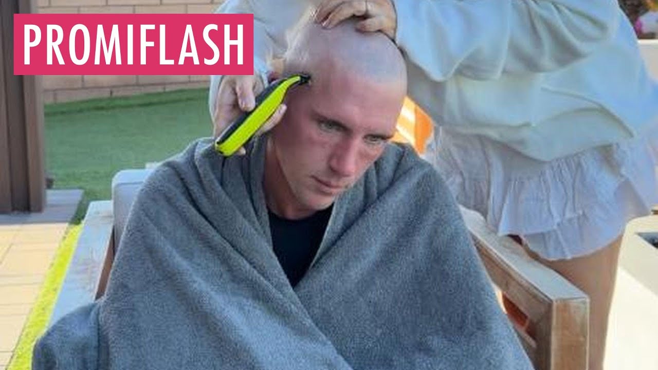 Kampf gegen Haarausfall: Tobi Wolf rasiert sich eine Glatze