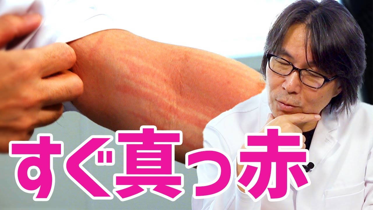 肌再生の専門家が、実は50年間戦っている皮膚病「皮膚描画症」についてお話します
