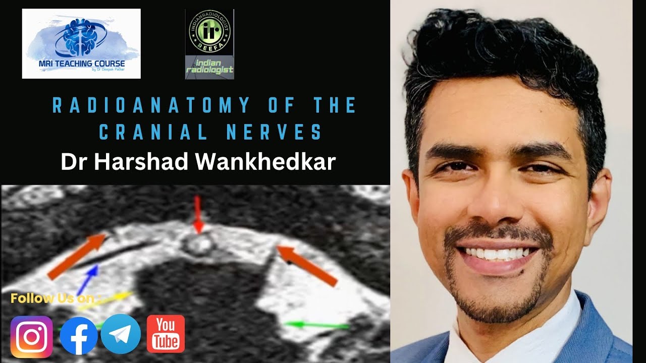 Radioanatomy of the Cranial Nerves | Dr Harshad Wankhedkar