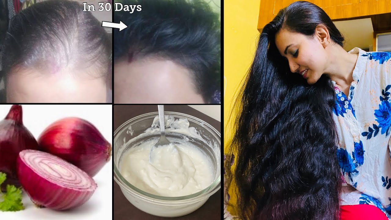 DIY Onion Hair Growth Mask : बालों की DENSITY और VOLUME को DOUBLE करें सिर्फ 30 दिनों में