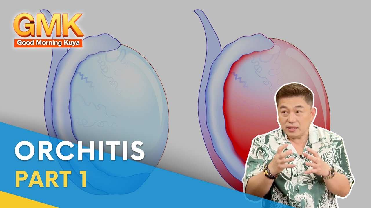 Orchitis: What Is It, Causes, Symptoms, and Treatment (Part 1) | Usapang Pangkalusugan