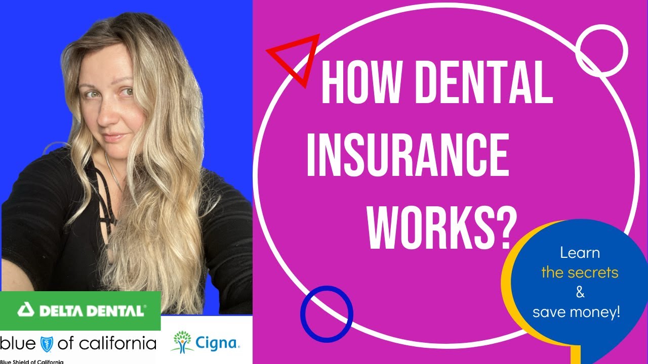 What is covered by Dental #Insurance and How to choose a #dental plan❓ 👑