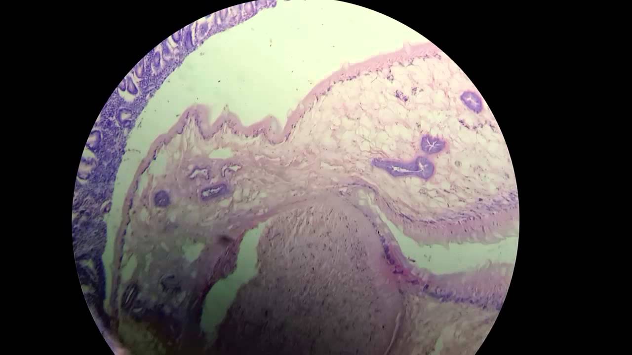 Faciola hepatica _pathology slide