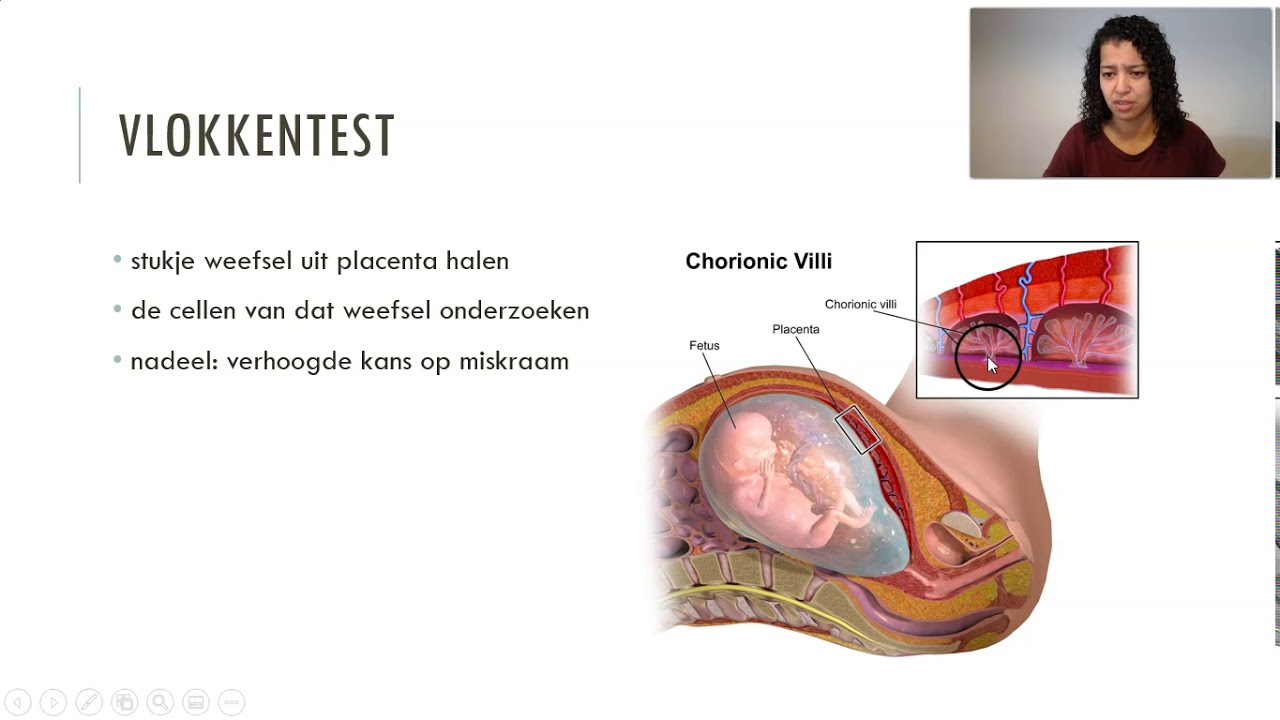 Prenataal onderzoek (vmbo)