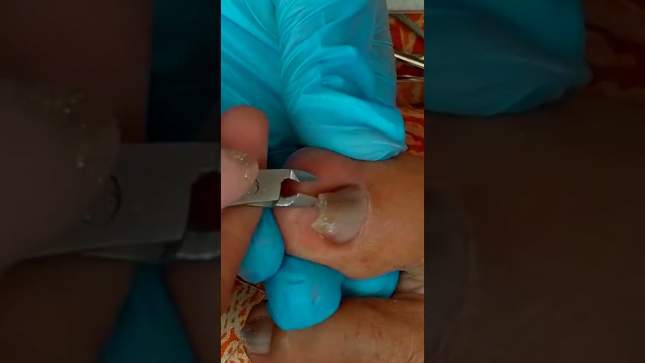 ✨ Super Satisfying Toenail ASMR ✂️💅✨🇺🇸 