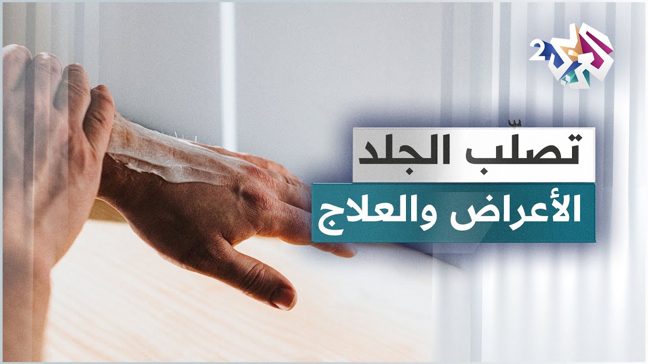 تصلّب الجلد .. أسبابه وأعراضه وطرق علاجه