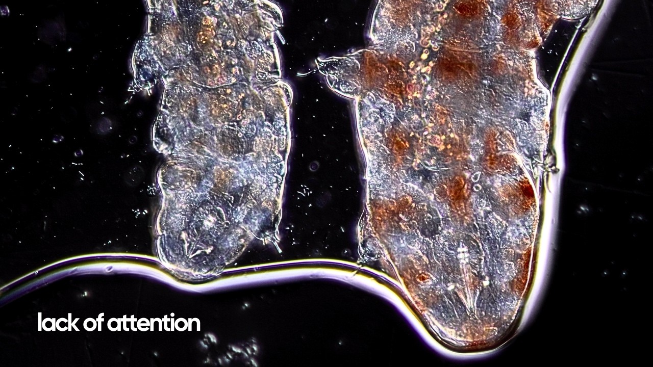 Lack of Attention — Original Music + Beautiful Microscopic Visuals