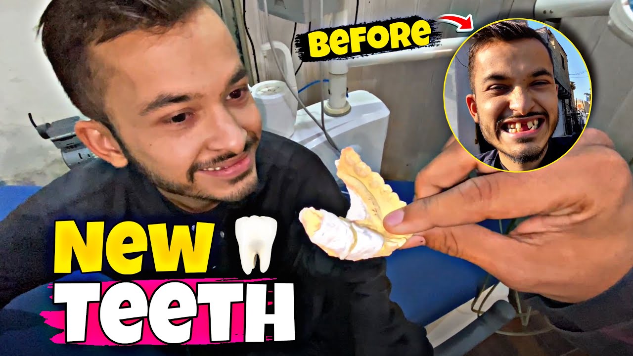 New Teeth New Vibes! 😎 | friend nay lagway new teeth |😅|sforshoaib 