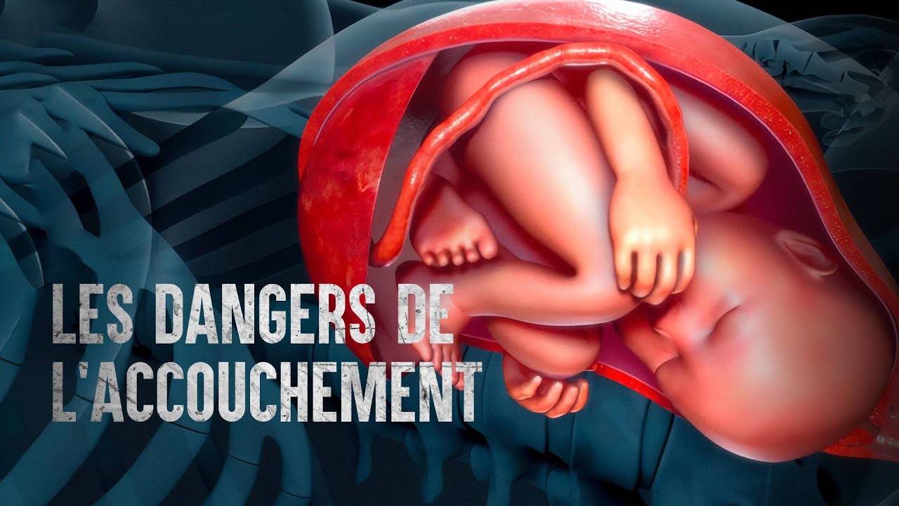 Les 7 complications dangereuses pendant l&rsquo;accouchement