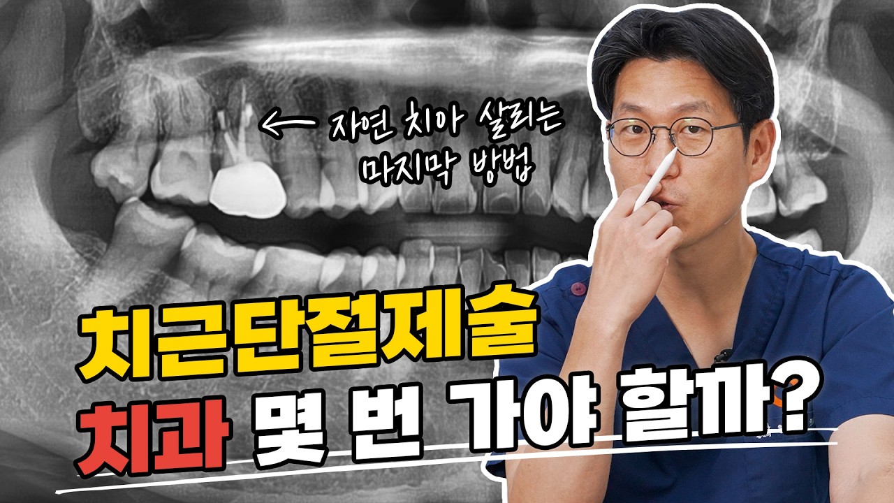 치근단절제술 내원 횟수와 기간은? 시술은 단 하루! 치아 살리고 싶다면 꼭 보세요 (미세현미경 치과)