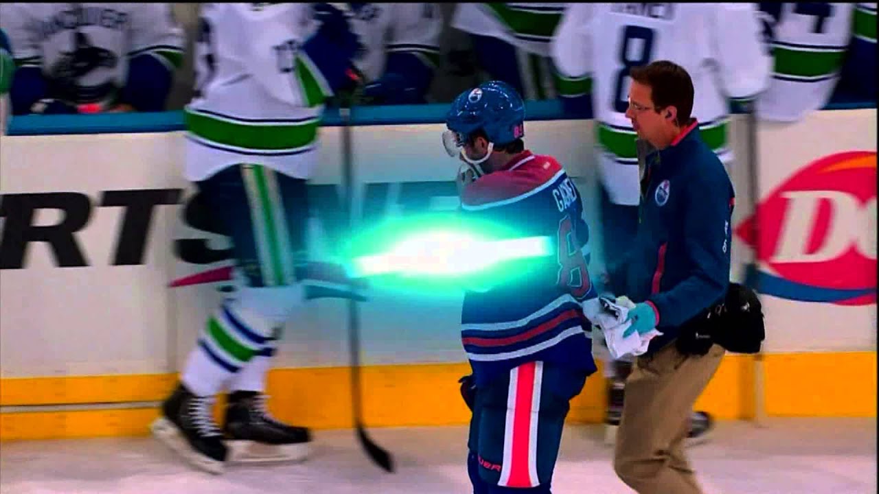 Video Request - Zack Kassian's high stick breaks Oilers' Sam Gagner's jaw