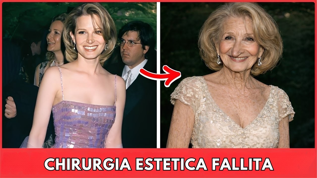 7 Atrizes Lindas de Hollywood Que Tiveram Transformações Polêmicas Após Cirurgias