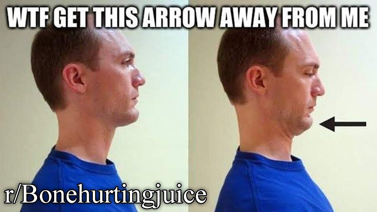 r/Bonehurtingjuice | click to cringe in 0.2 seconds