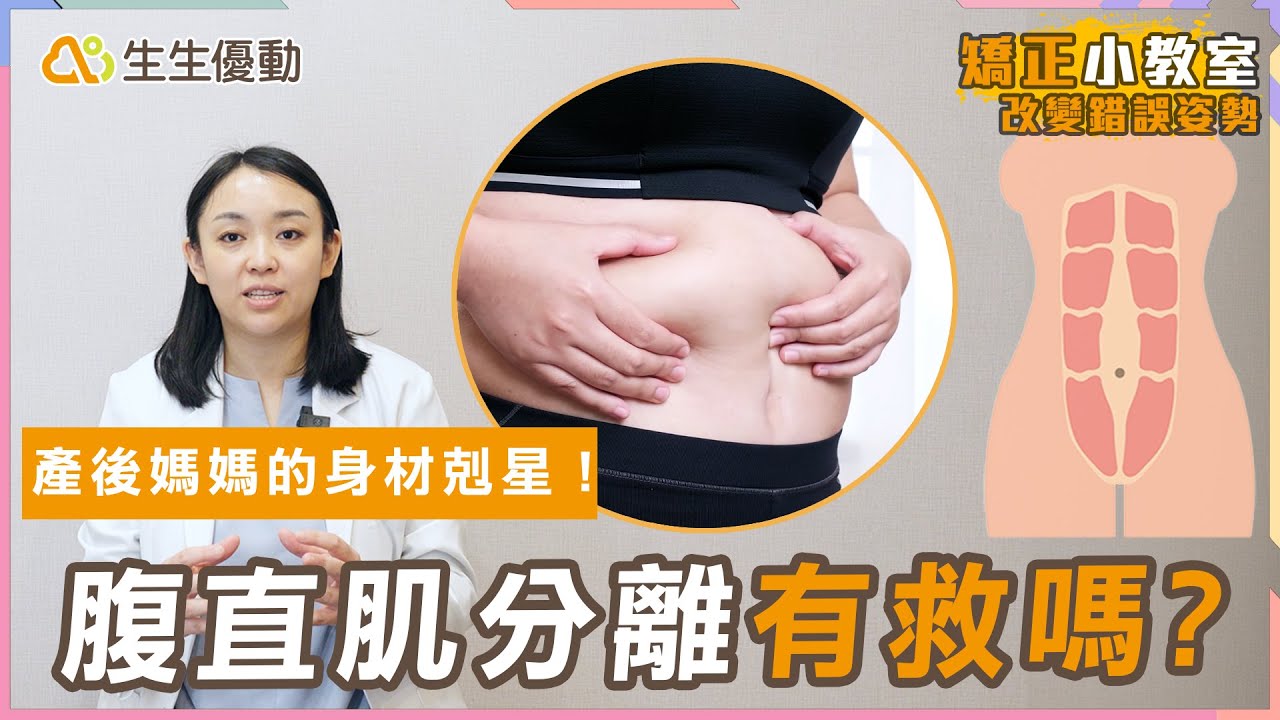 產後腹直肌分離怎麼辦？小腹鬆垮、腰痠背痛這樣改善！【矯正小教室 EP.10】