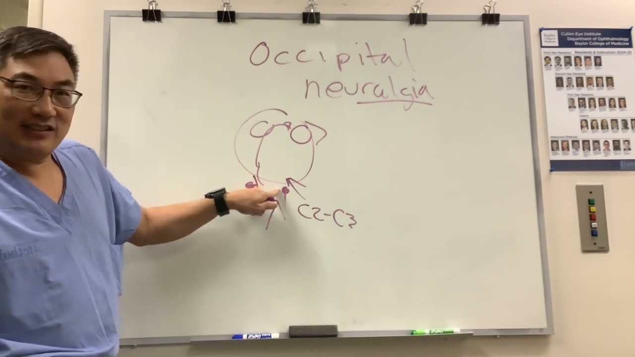 Occipital Neuralgia