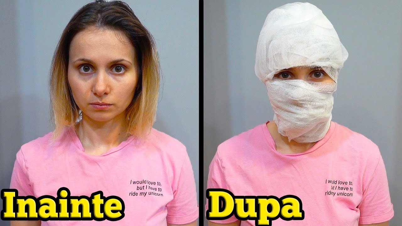 Spitalul #5 - Operatia Plastica nu a Mers cum Trebuie
