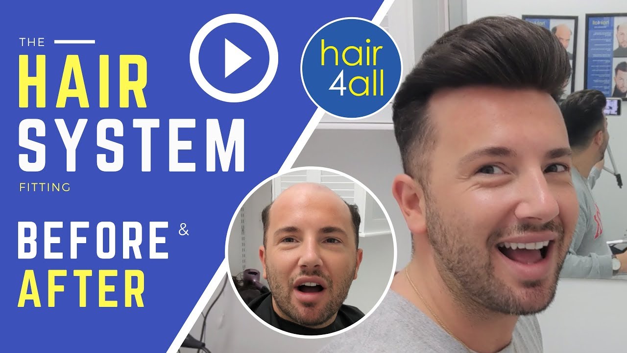 Before & After | Hair System | Non-Surgical Hair Replacement System for Men/Women | UK/USA/INTL